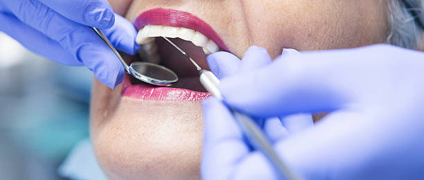 Best Emergency Root Canal Treatment in West Siloam Springs, OK